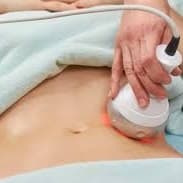 Cavi / Lipo Combo Package of 6 at Viva la Contour in Woodbridge, NJ