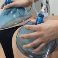 BBL Booty Lift pkg of 6 at Viva la Contour in Woodbridge, NJ
